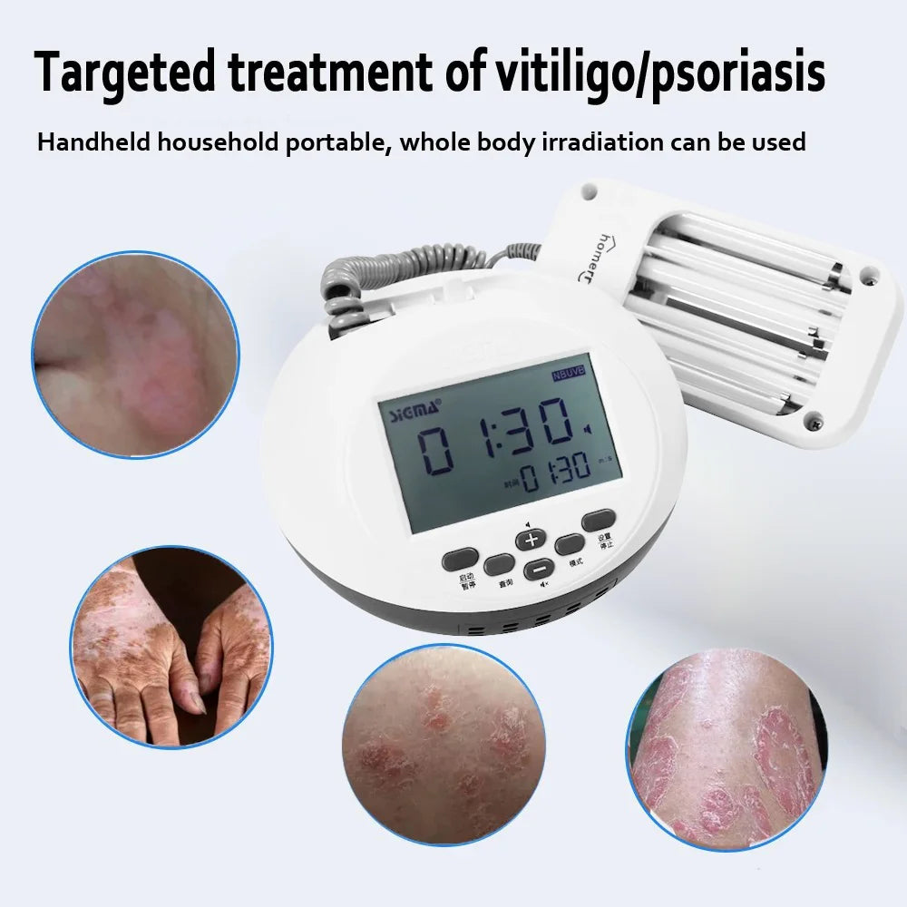 UVB Therapy Lamp – 311nm Narrowband Light for Psoriasis & Vitiligo